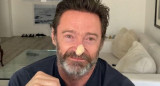 Hugh Jackman mostró su estado en redes sociales.