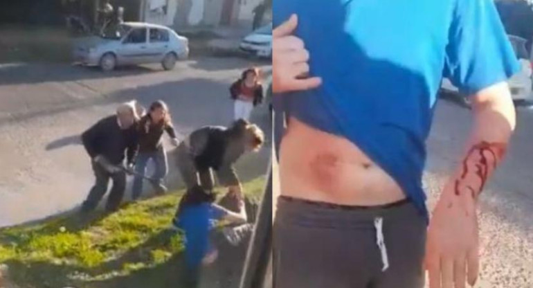 Ataque de un pitbull a un hombre en Bahía Blanca. Foto: NA