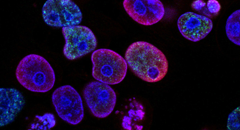 Células de cancer. Foto: Unsplash