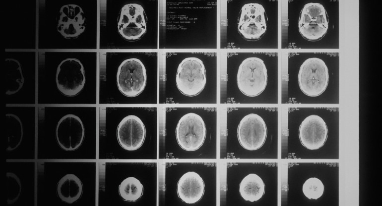 El funcionamiento del cerebro humano continúa siendo un misterio para los médicos e investigadores. Foto: Unsplash.