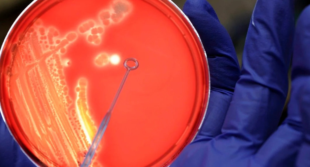 Bacterias en análisis de la Escherichia coli. Foto: EFE