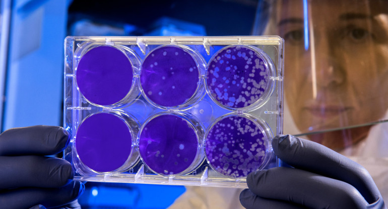Estudias como terminar la resistencia bacteriana. Foto: Unsplash