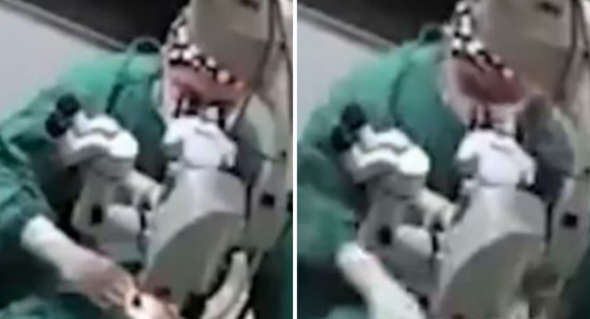 Un médico de China golpeó a una paciente durante una cirugía de ojos. Foto: captura de video.