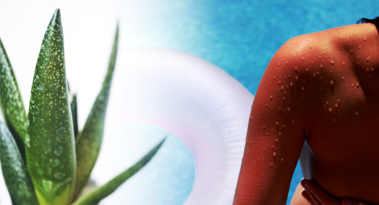 Aloe vera: el secreto para que haga un efecto rápido sobre las quemaduras solares en la piel. Foto: Pexels