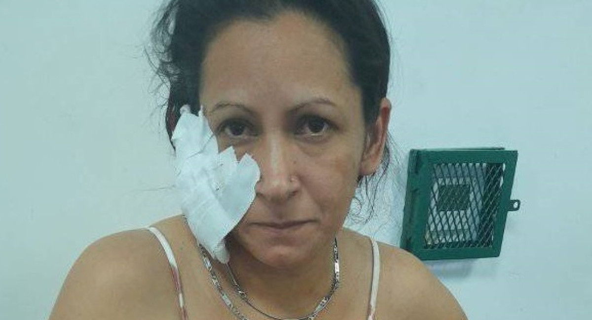 Pamela San Martin fue agredida por su pareja en Avellaneda. Foto: Facebook: Pamela San Martin