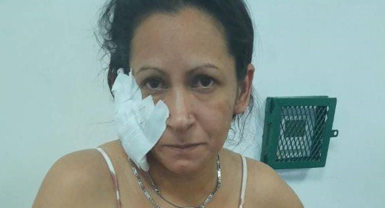 Pamela San Martin fue agredida por su pareja en Avellaneda. Foto: Facebook: Pamela San Martin