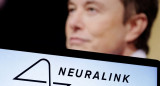 Elon Musk, Neuralink. Foto: Reuters.