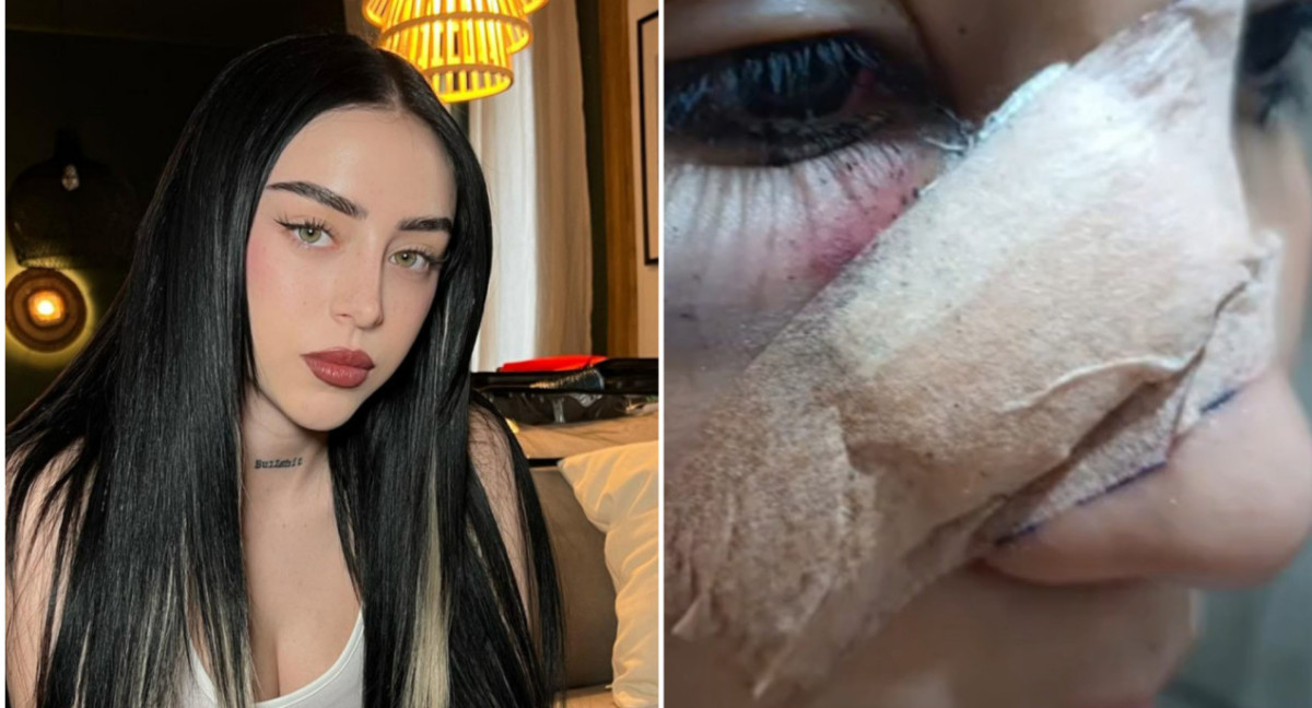 Fan de Nicki Nicole terminó herida por un botellazo. Fotos: Instagram - captura video.