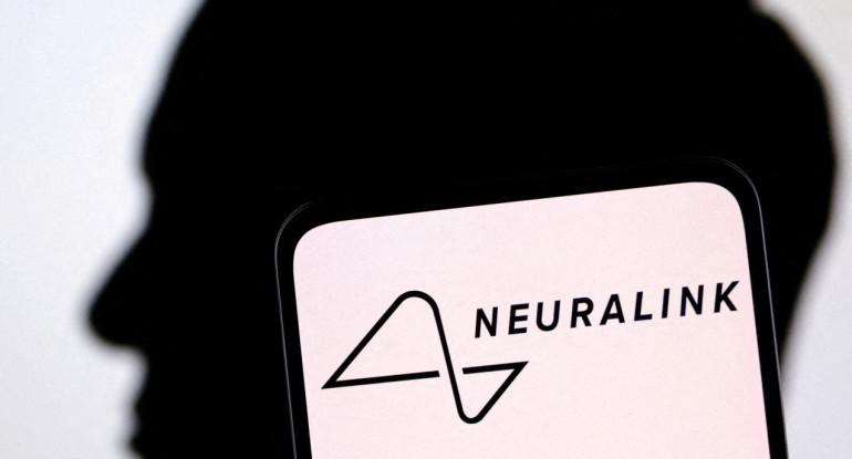 La empresa de neurotecnología, Neuralink. Foto: Reuters