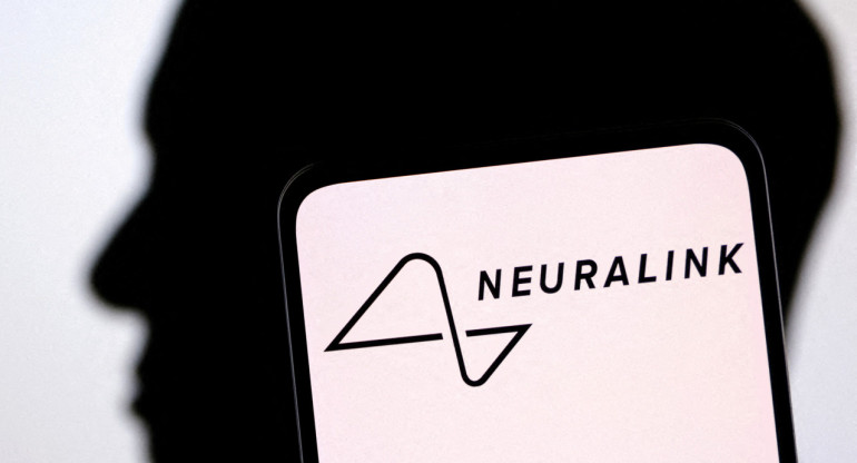 La empresa de neurotecnología, Neuralink. Foto: Reuters