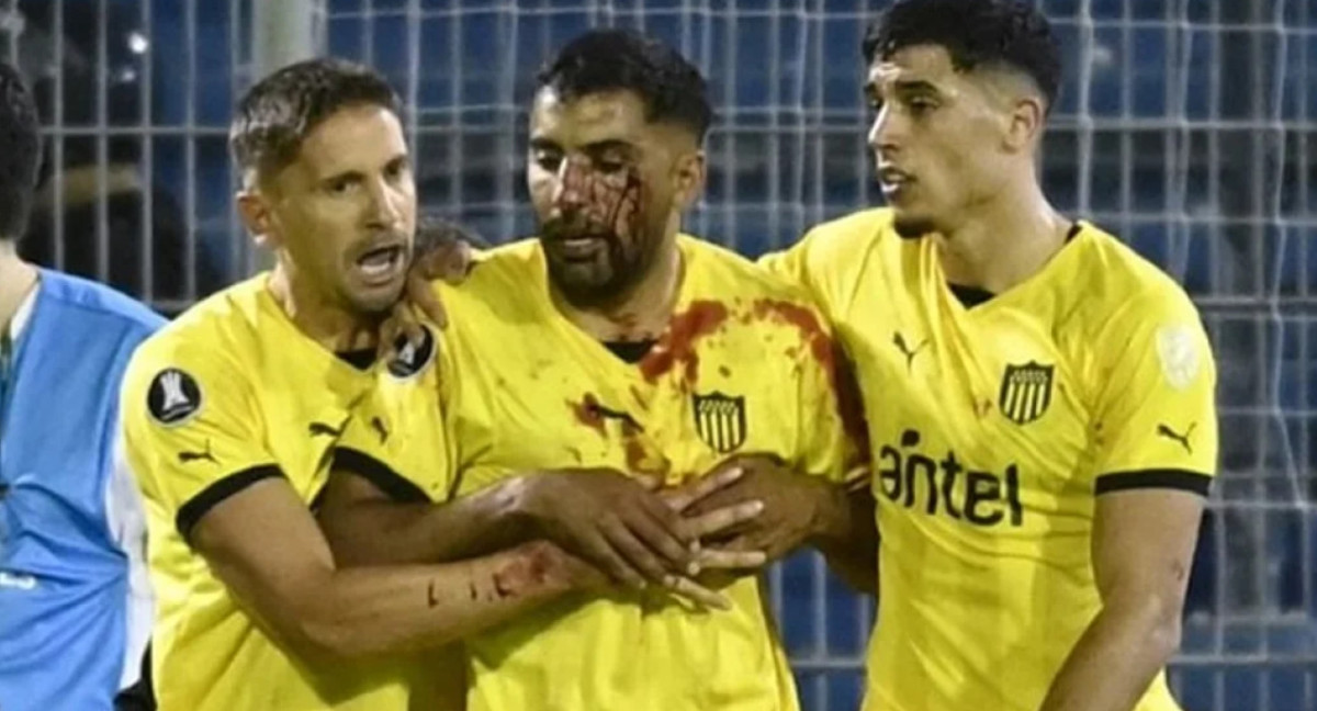 Un jugador de Peñarol fue agredido tras el partido ante Rosario Central. Foto: NA.