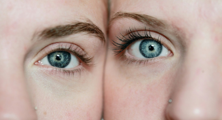 Color de los ojos. Foto: Unsplash