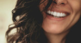 Dientes blancos. Foto Unsplash.