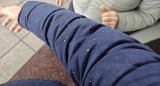 Graupel. Foto: NA