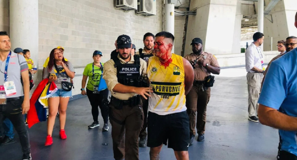 Incidentes en Argentina-Colombia, Copa América. Foto: NA