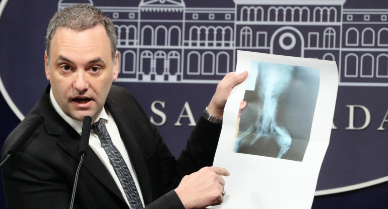 Manuel Adorni muestra la radiografía de un perro. Foto: Prensa Presidencia
