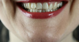 Sonrisa; dientes. foto: Unsplash