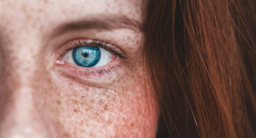 Color de los ojos. Foto: Unsplash