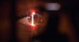 Salud ocular. Foto: Unsplash.