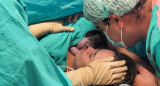 Beba que fue operado en el útero de su madre en el Hospital Garrahan. Foto: Gentileza Hospital Garrahan.
